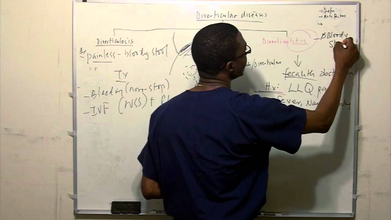 Diverticular diseases -(Diverticulosis/Diverticulitis) in HD
