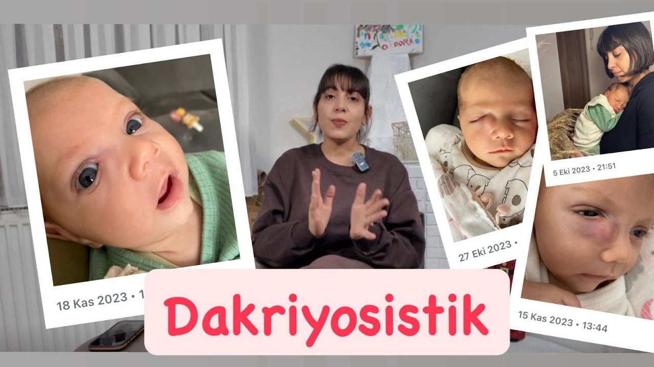 Gözyaşı Kanalı Tıkanıklığı Nedir ⁉️ Deneyimlerimiz | Korku 😨