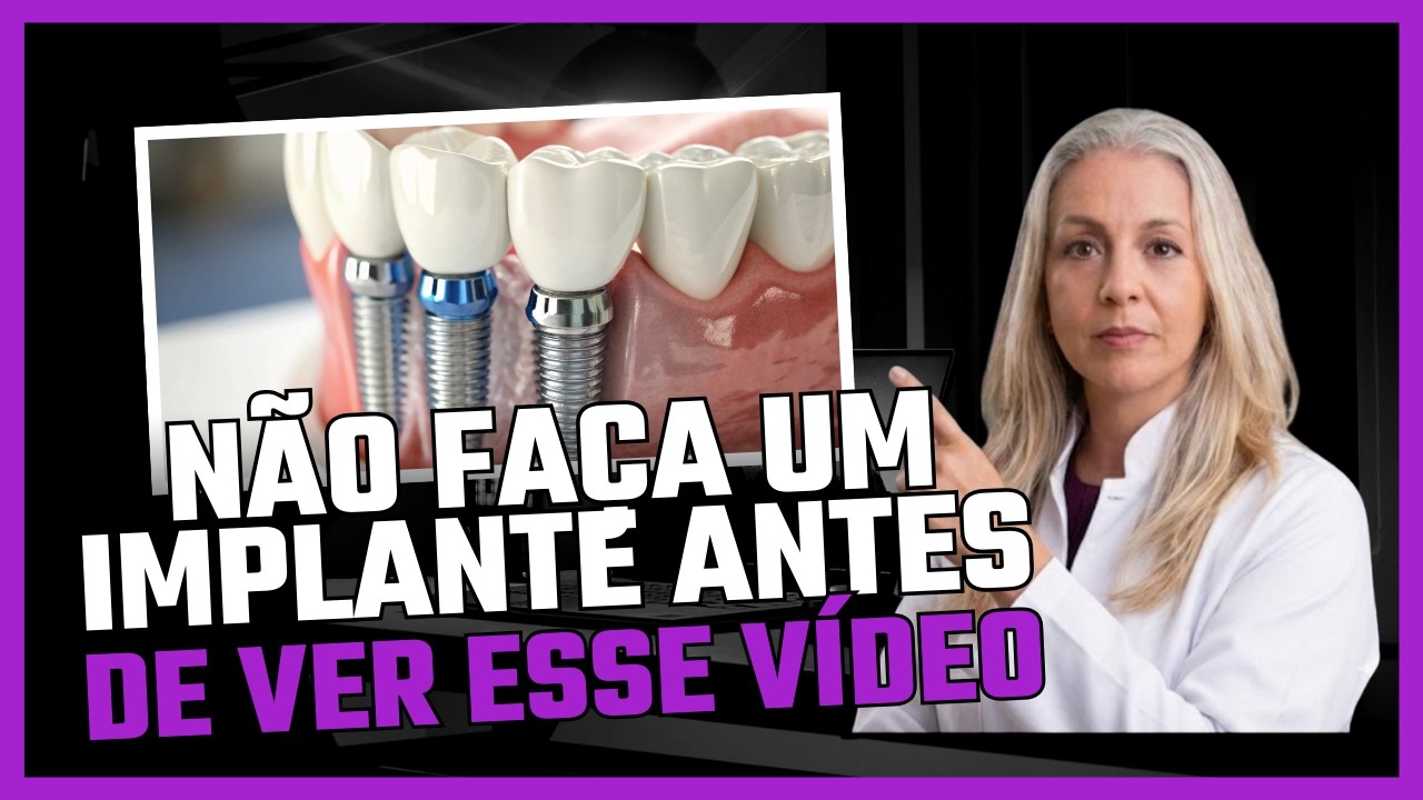 Implante do início ao fim: guia completo