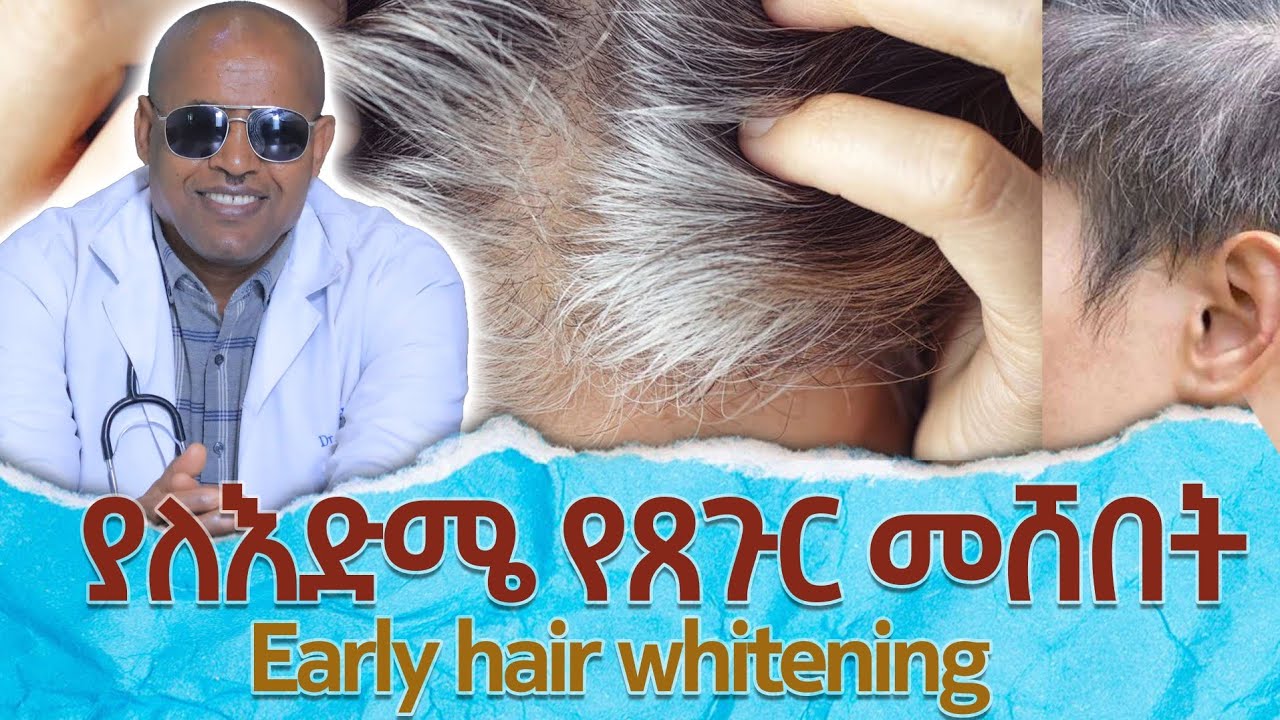 🔴 ያለ እድሜ የፀጉር መሸበት | Early hair whitening