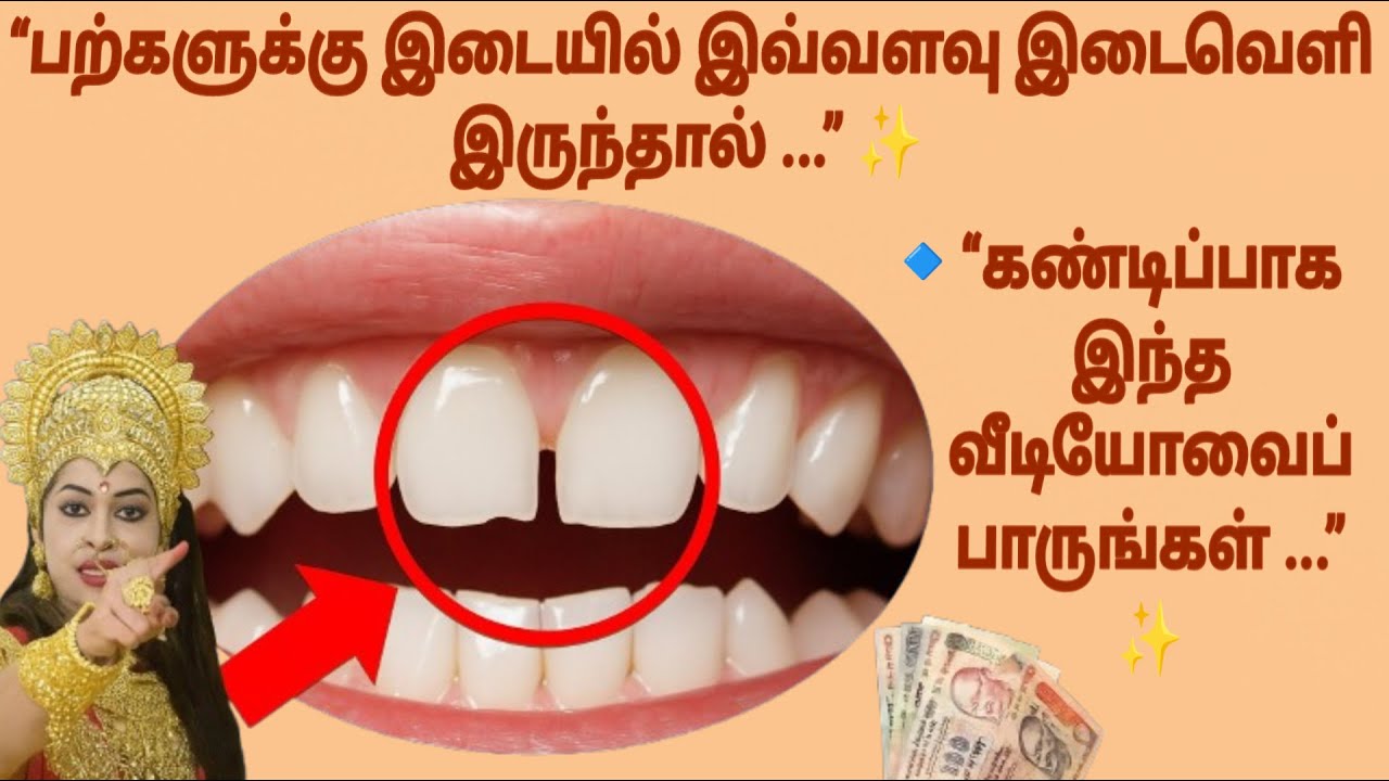 பற்களுக்கு இடையில் இடைவெளி இருந்தால் கண்டிப்பாக பாருங்கள் #படித்ததில்பிடித்தது #tamilstory #tamil