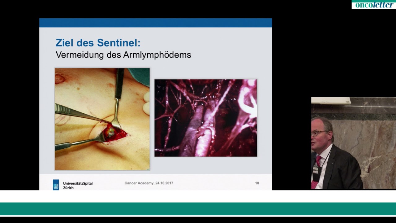 Prof. Daniel Fink: Personalisierte Therapie bei Brustkrebs