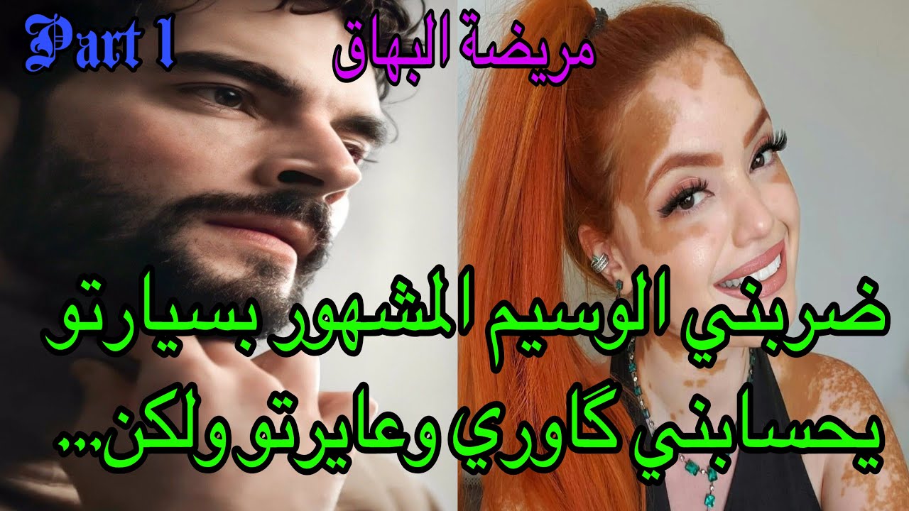 1️⃣ضربني بسيارتو 🤨عايرتو بالدارجة يحسابني گاوري🤣أحبني المشهور الوسيم وأنا مريضة البهاق 😍