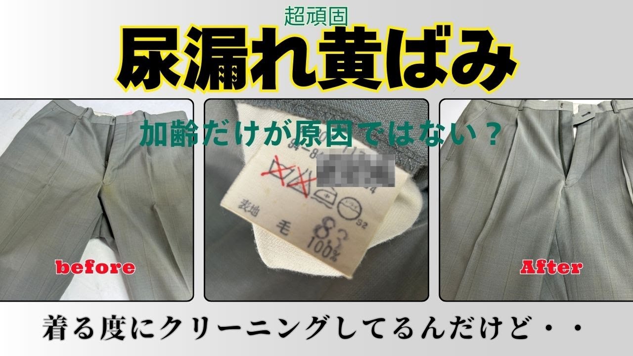 尿漏れで黄ばんだズボンの股を染み抜き