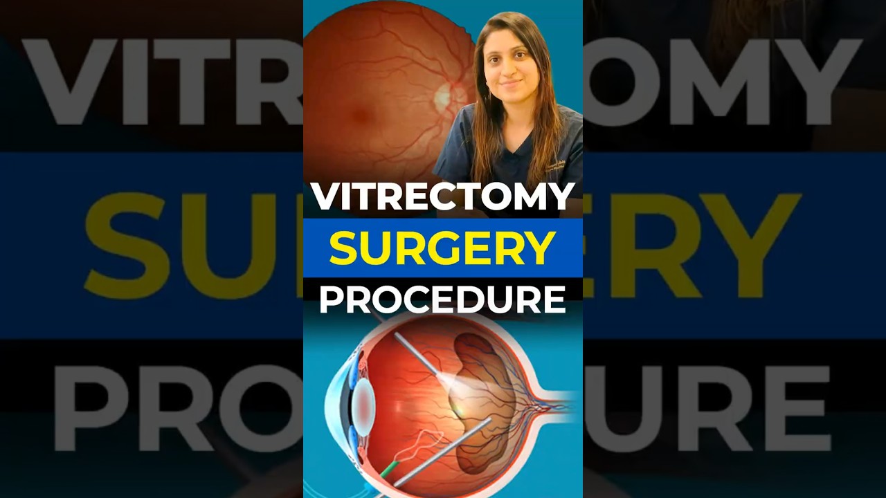 Vitrectomy Surgery Procedure Explained | Retinal & Vitreous Problems