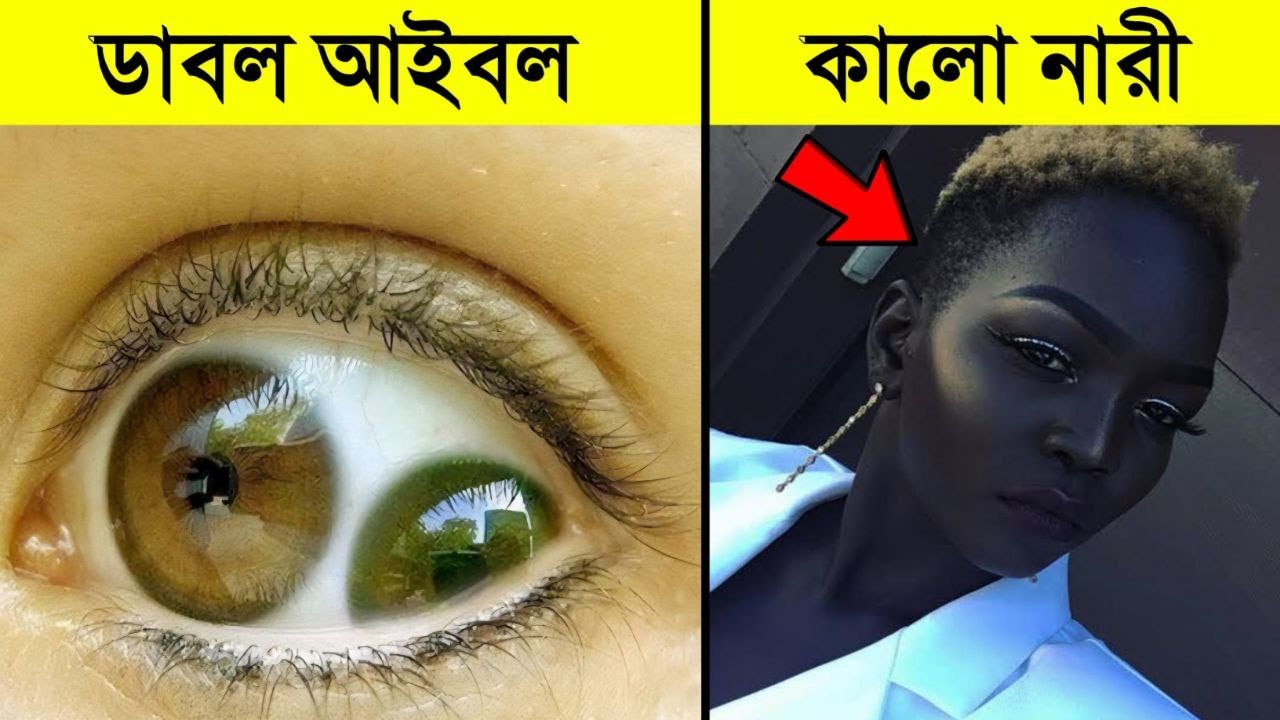 আপনার বিশ্বাসই হবে না এমন অদ্ভুত মানুষও পৃথিবীতে আছে | Humans with the rarest body features
