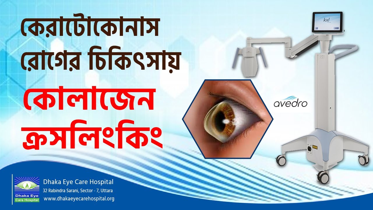 Keratoconus Treatment | Prof. Dr. Harun Ur Rashid | Dhaka Eye Care Hospital