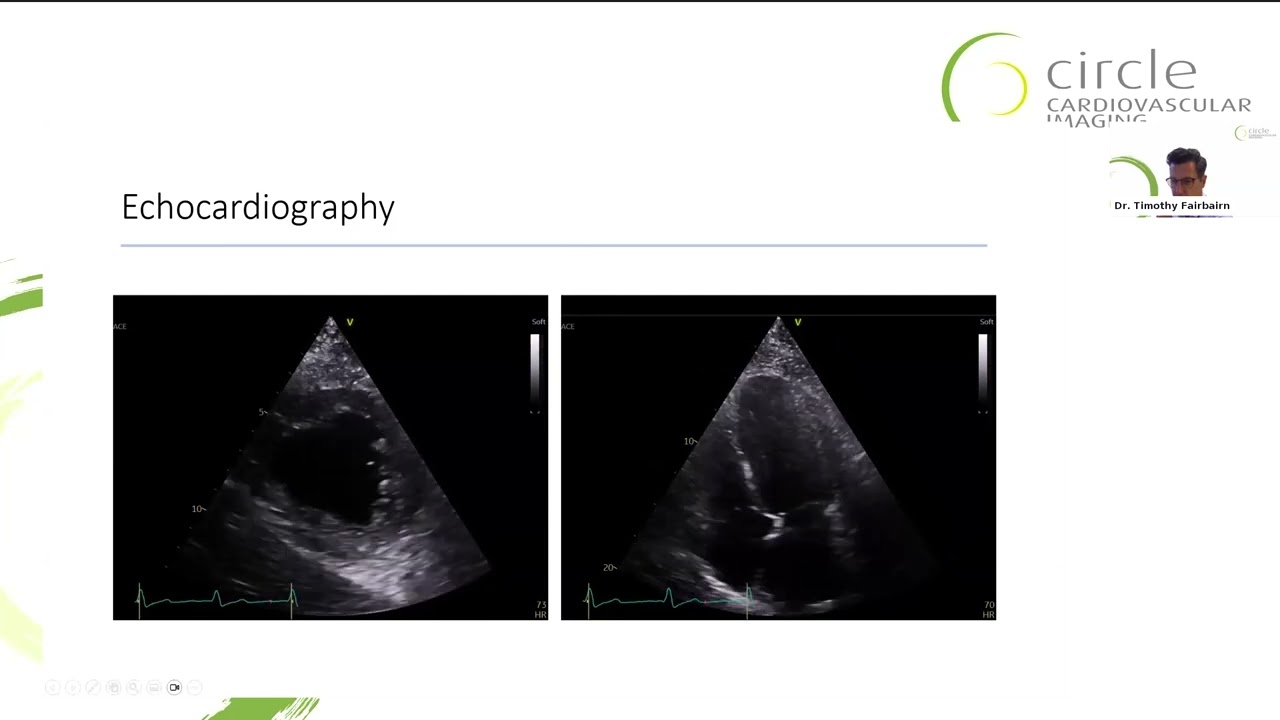 Sponsored webinar | Advantages of a single imaging software platform for your cardiac service line