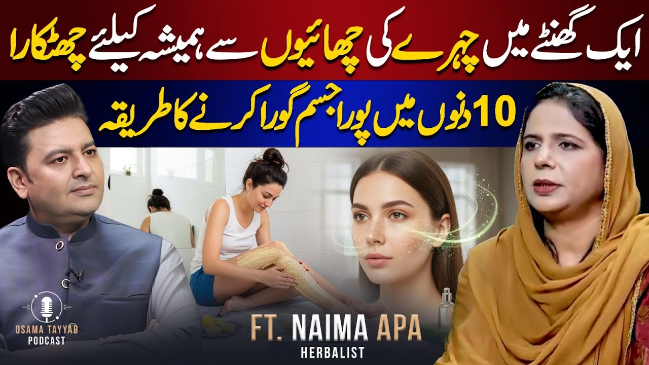 Full Body Whitening in 10 Days | How to Treat Melasma & Pigmentation in 1 hour | Ft. Naima Apa