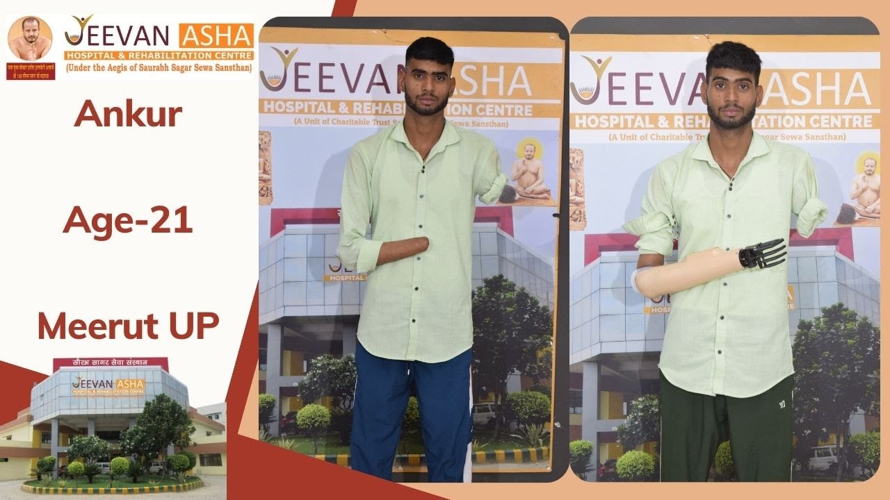 Ankur lost both hand in a accident Jeevan Asha Hospital provided him free of cost Mayo Electric Hand