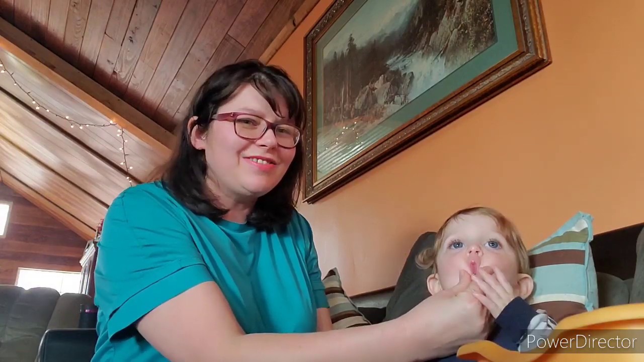 Hypotonia oral motor exercises dysphagia