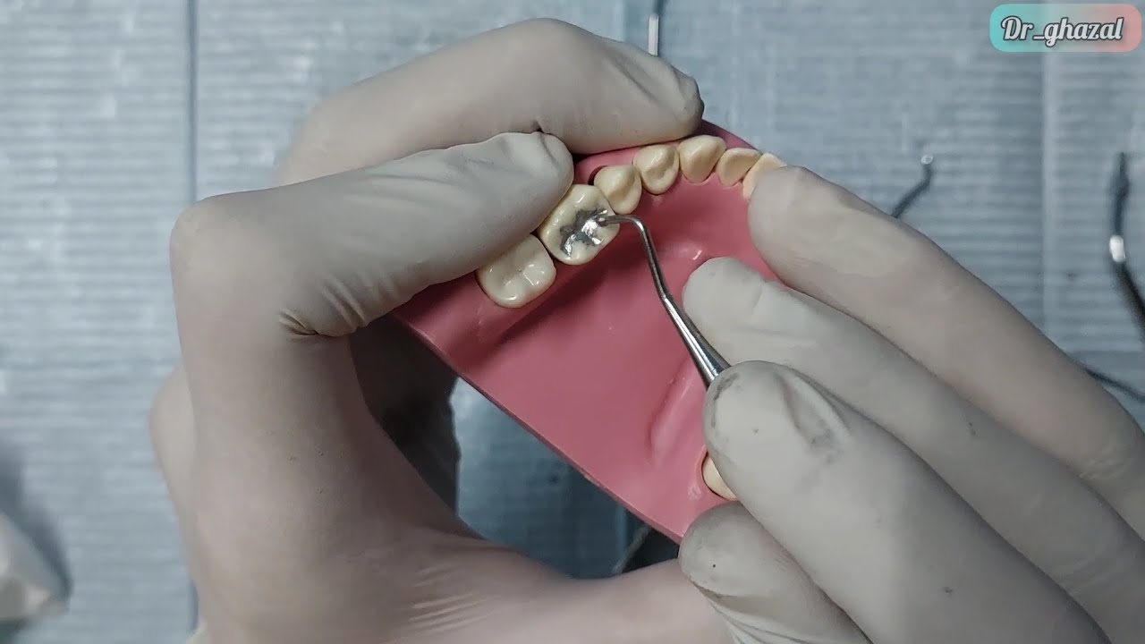ازاى تعمل Class I Amalgam restoration cavity preparation
