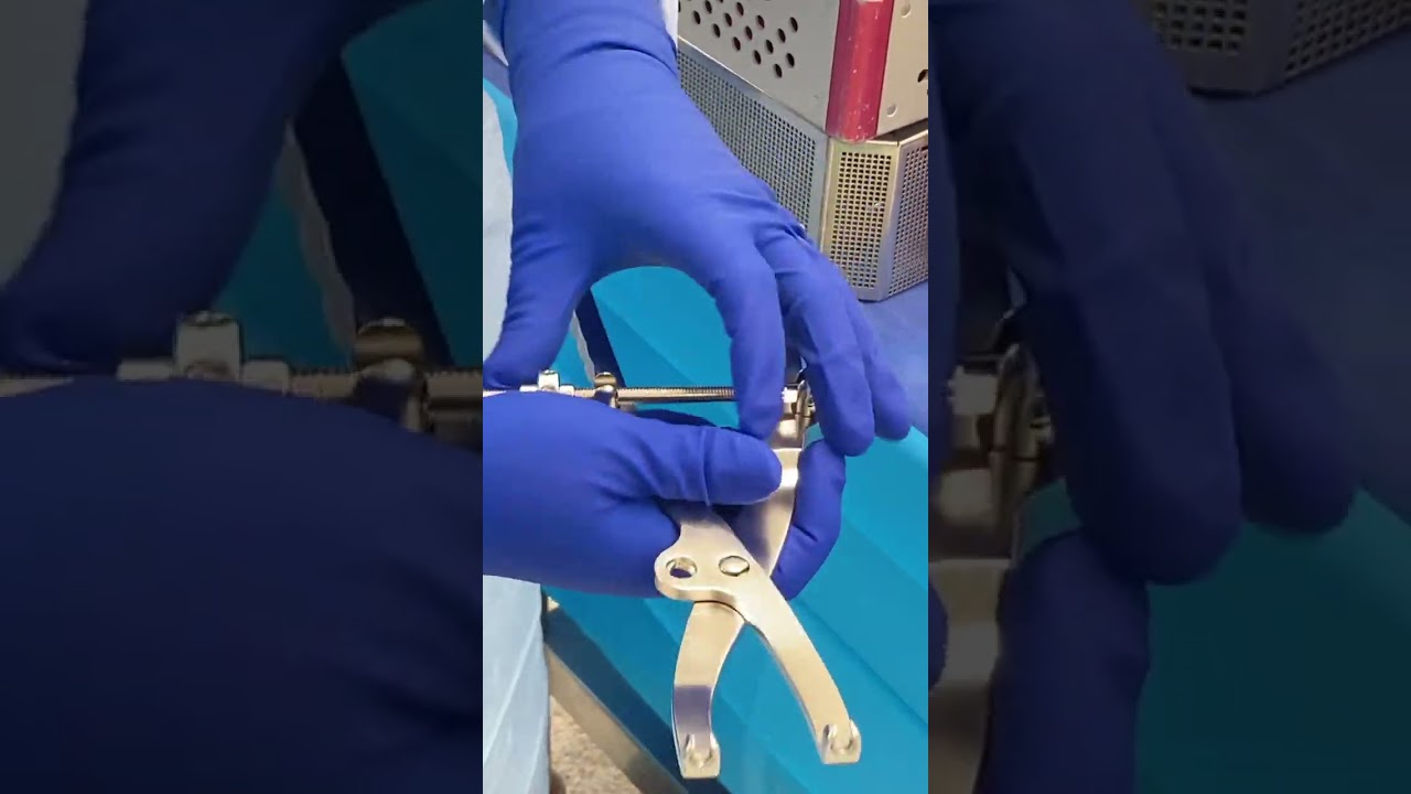 Synthes Pelvic Trays for Posterior Wall Pelvis