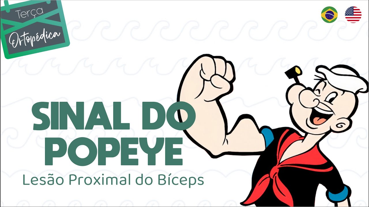 Lesão Proximal do Bíceps - SINAL DO POPEYE (Ortopedista Ombro e Cotovelo - Dr. Eric Curi)