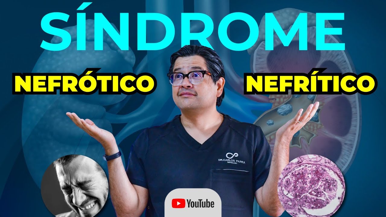 ENTENDIENDO el Síndrome Nefrótico y Nefrítico: Implicaciones en la Salud Renal