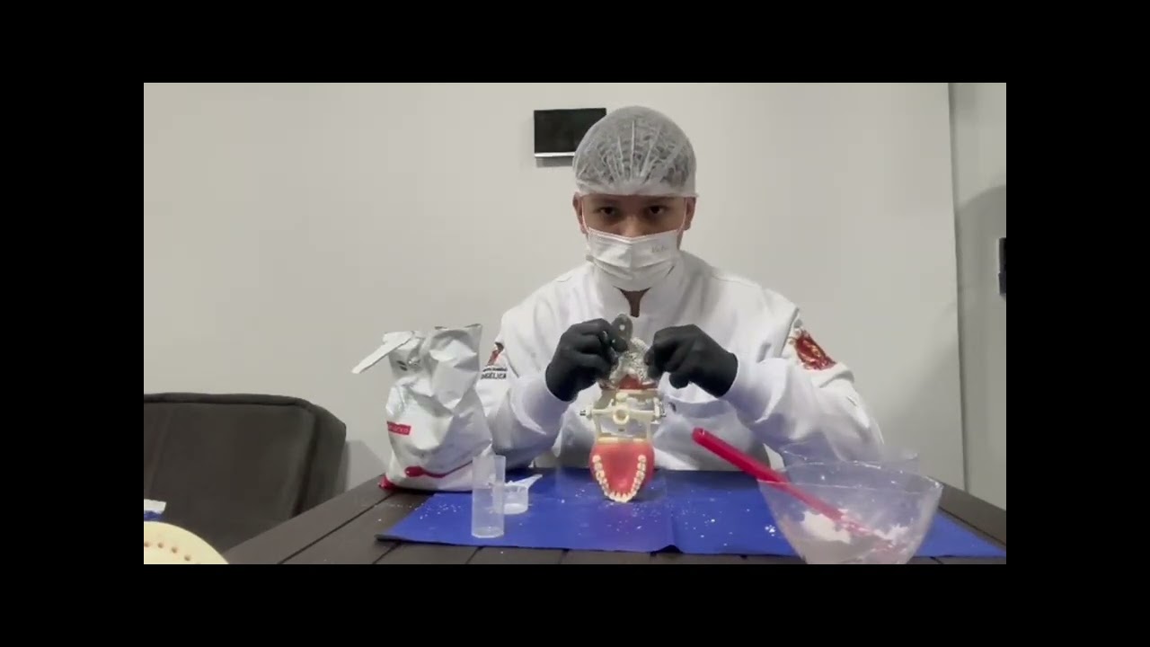 Moldagem dos dentes superiores e inferiores - OCLUSÃO 
