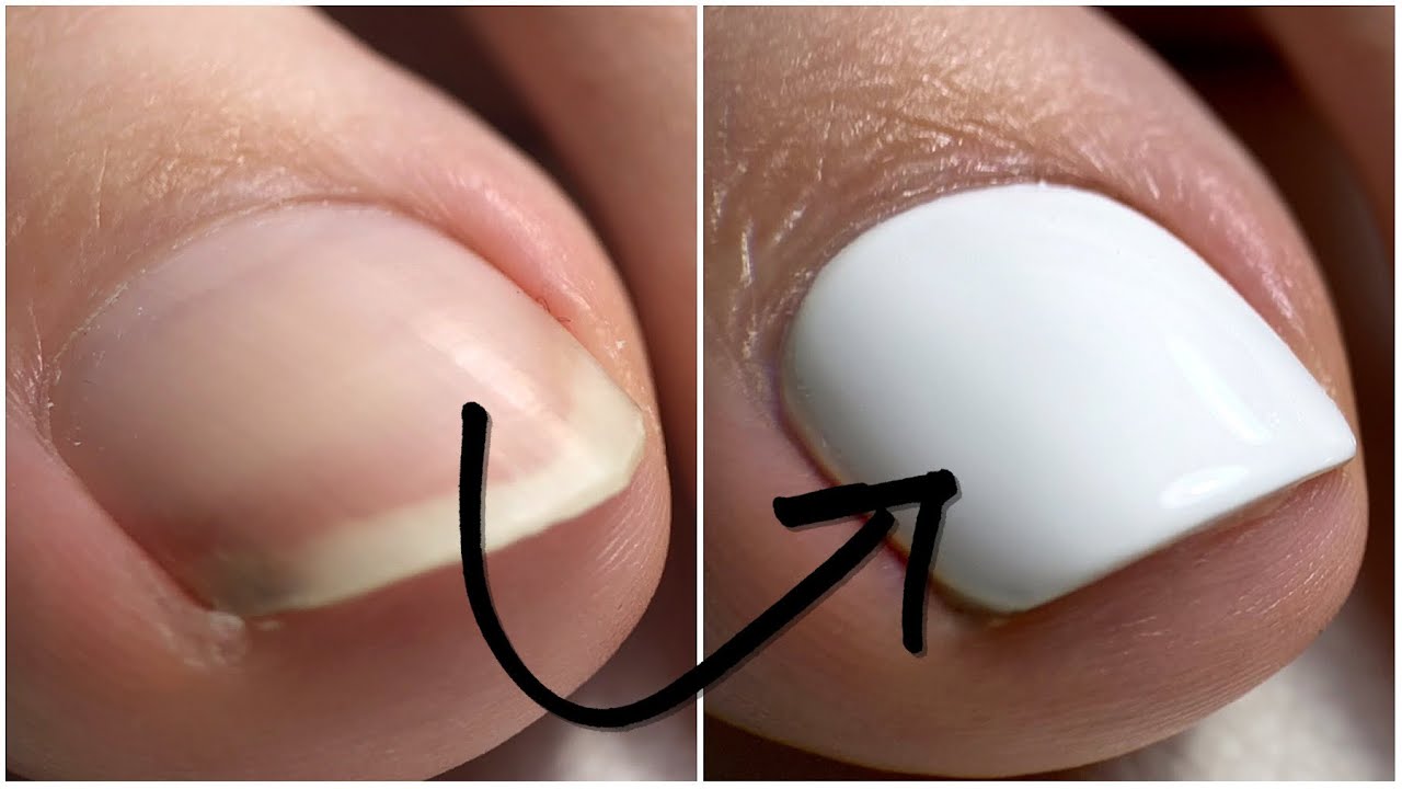 PÉDICURE combinée avec pose de vernis semi permanent ! 🦶🏻