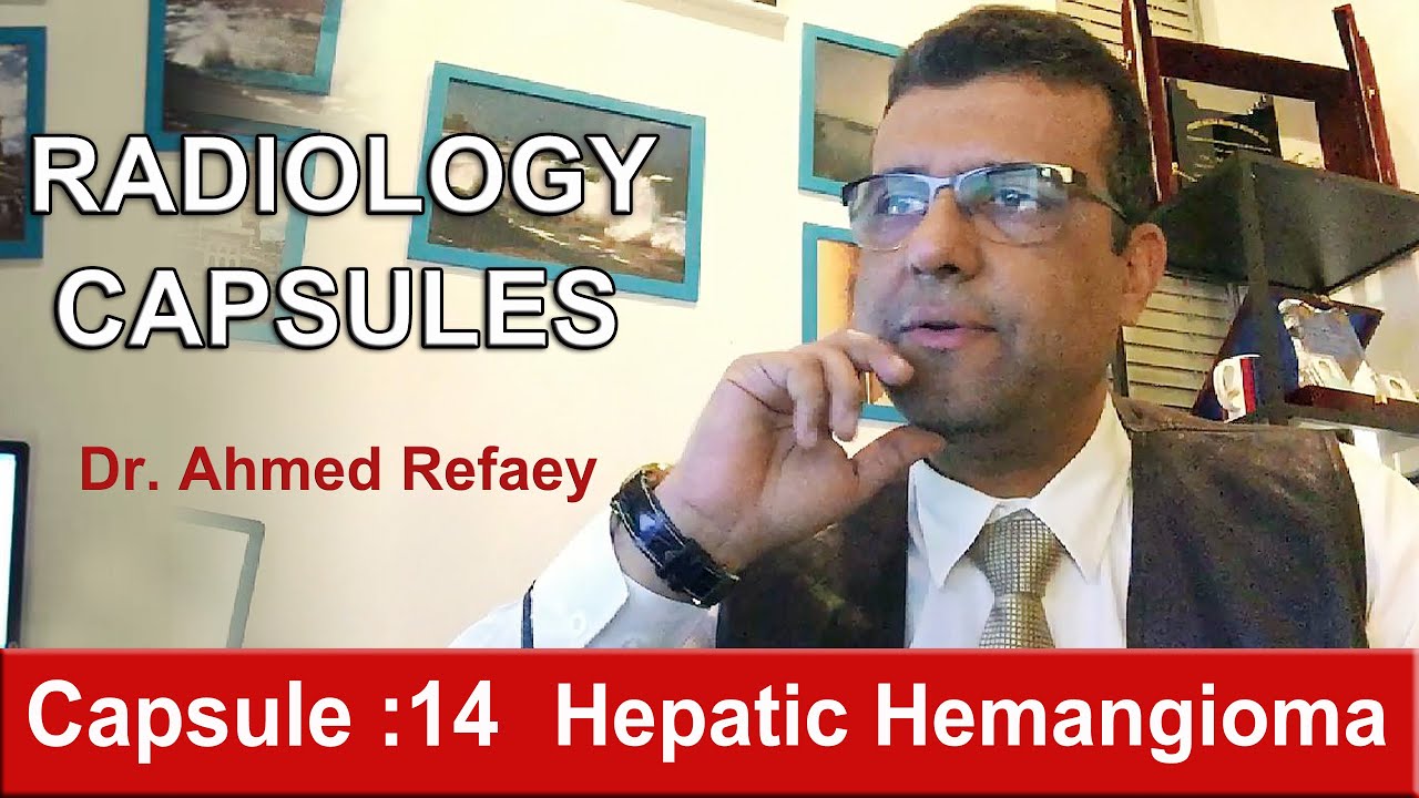 Capsule : 14 - Hepatic Hemangioma