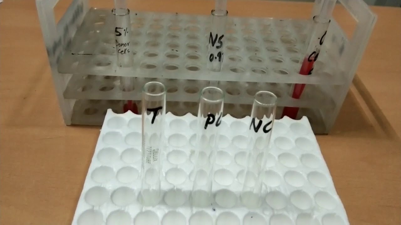 Du Test by tube technique