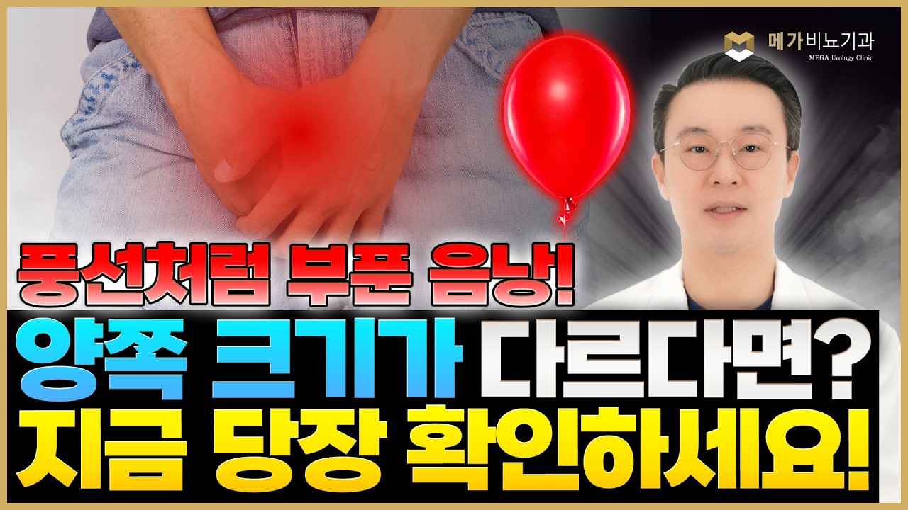 고환이 자꾸 커진다?! 방치하면 정말 큰일나는 '음낭수종'의 모든 것! [메가비뇨의학과 강서마곡점]
