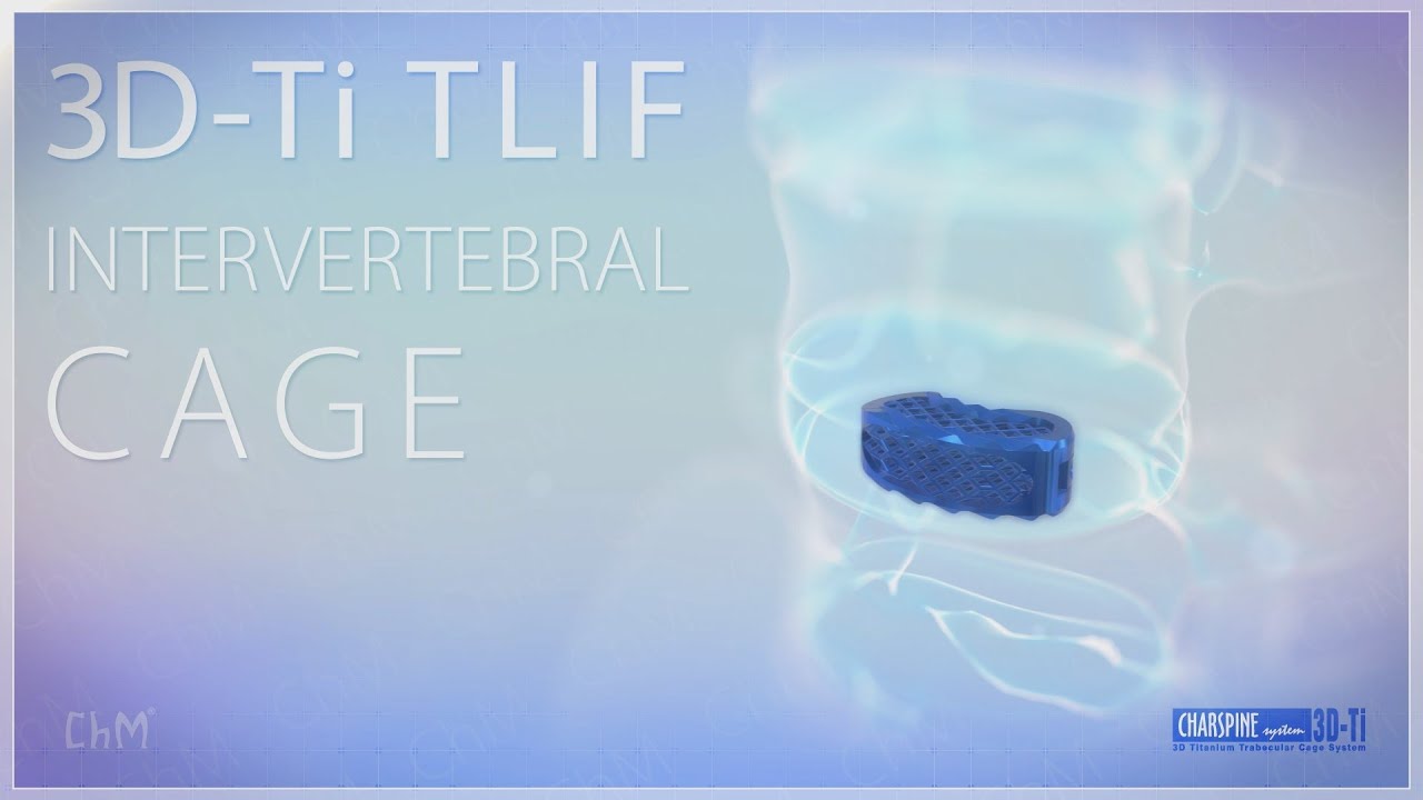TLIF INTERVERTEBRAL CAGES