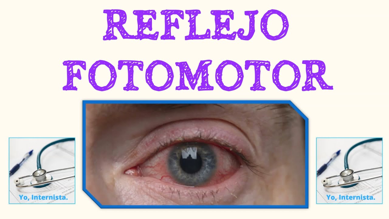 REFLEJO FOTOMOTOR - FACIL