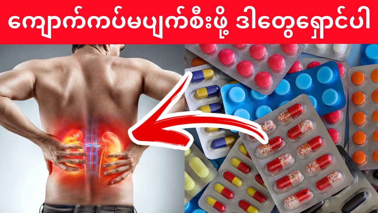 ‼️ကျောက်ကပ်ထိခိုက်ပျက်စီးမှာကြောက်ရင် ဒီ (၅) ချက်ကို မဖြစ်မနေသိထားပါ