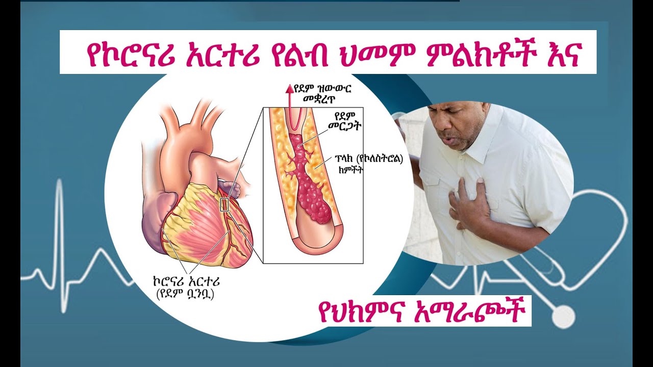 CAD (Coronary Artery Disease) የኮሮናሪ አርተሪ የልብ ህመም እና ድንቅ የህክምና አማራጮች