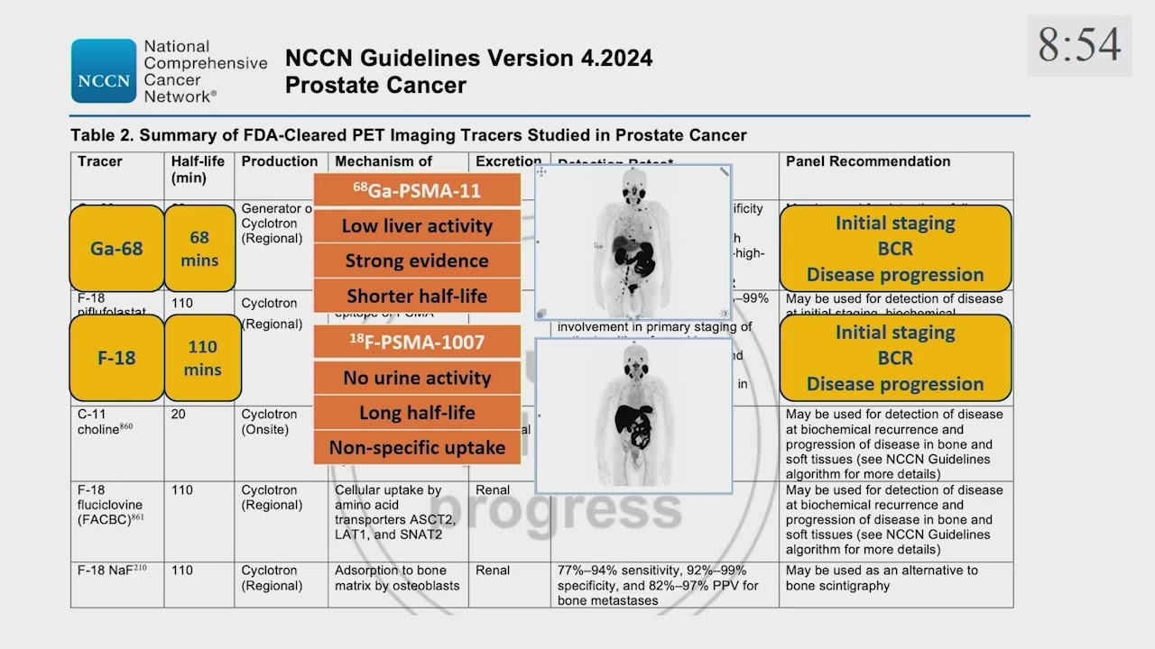 Advancements in PSMA targeted therapy for prostate cancer Current status and future perspectiv