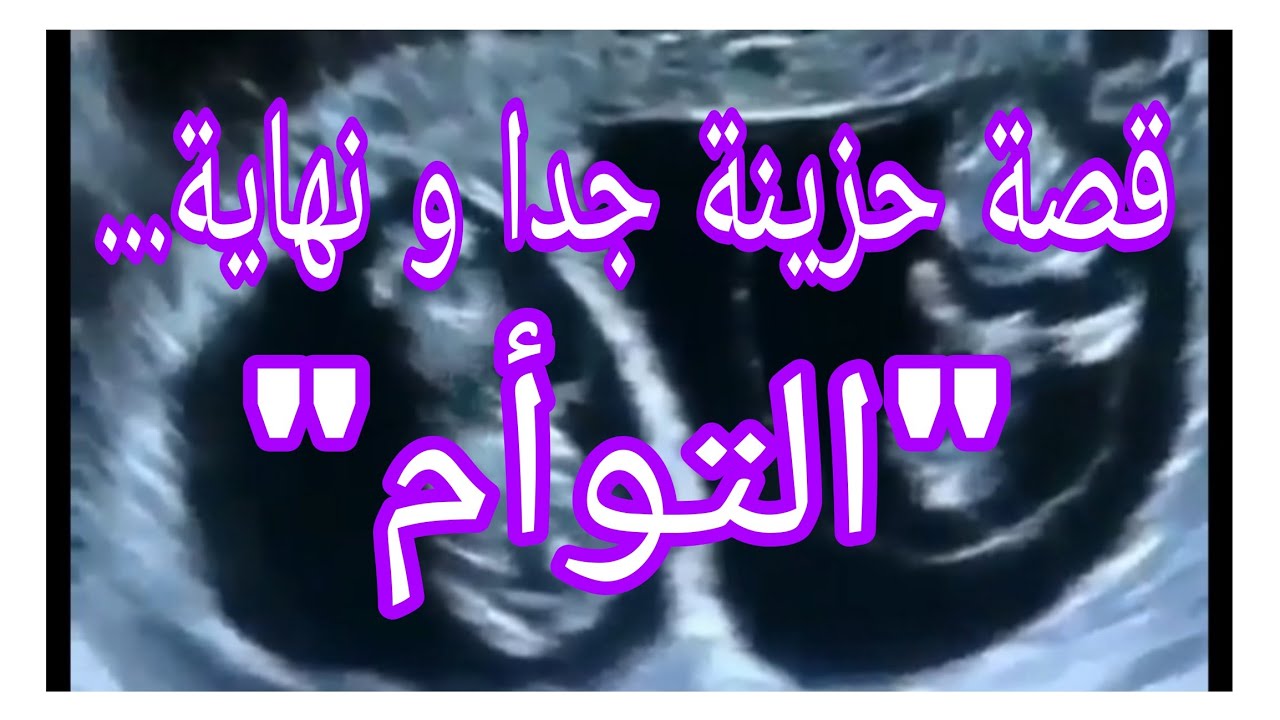 قصة اجتماعية حزينة جدا.... التوأم...#ام_يعقوب_للقصص #احكيلي #lyly_dz 