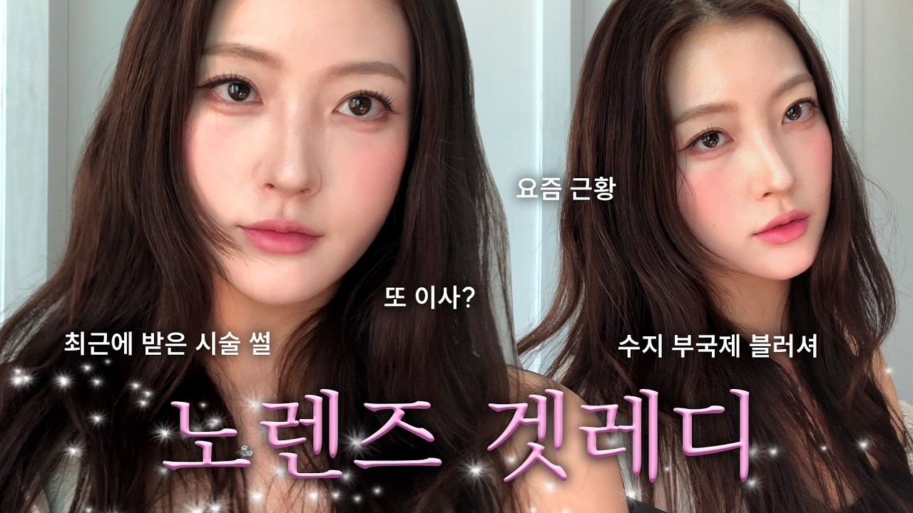 최근에 받은 시술 썰 풀면서 노렌즈 겟레디윗미💖, 눈밑지상담, 이사 또 갑니다..