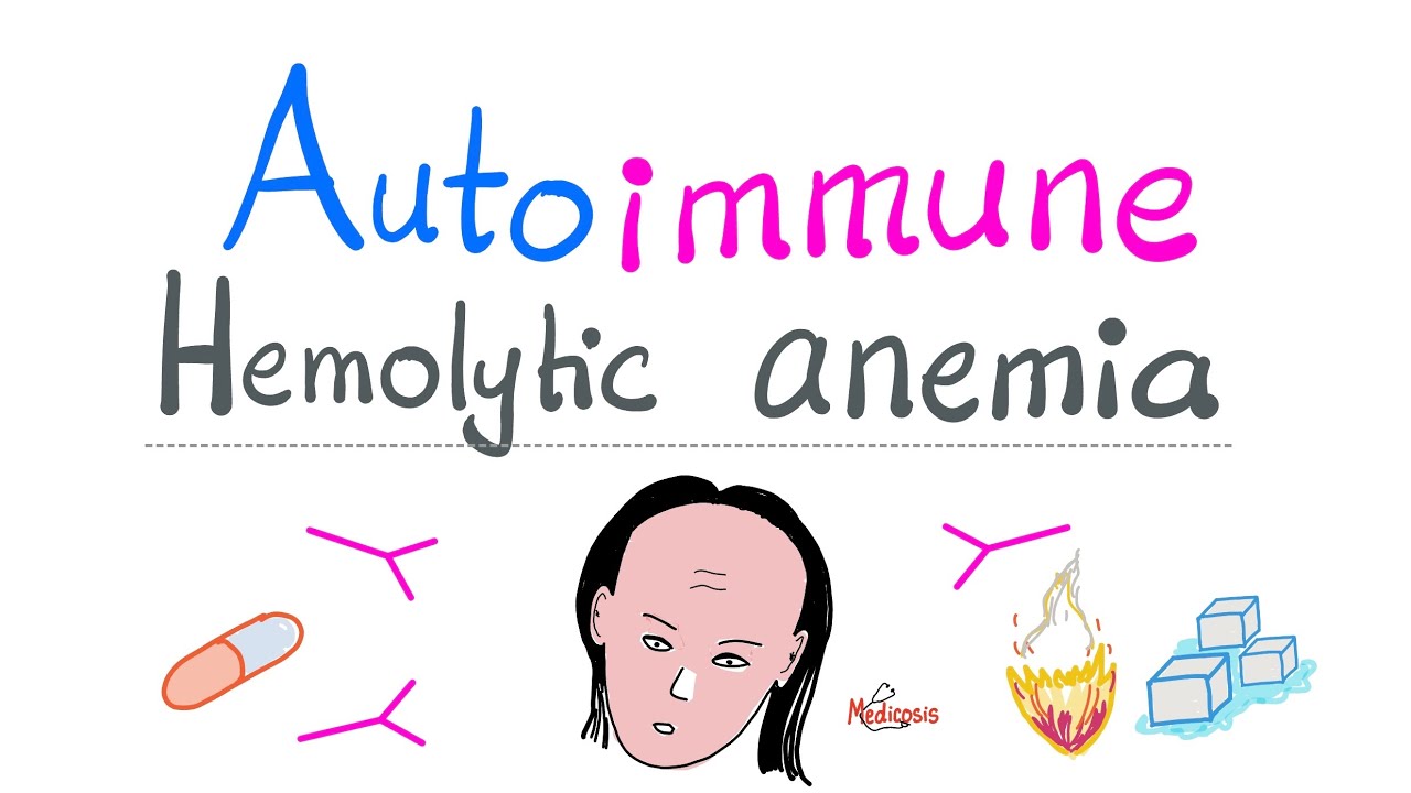 Autoimmune Hemolytic Anemia (AIHA) - Warm Autoantibodies (IgG) - Hemolysis of RBCs - Hematology