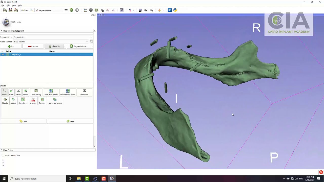 3D slicer Arabic tutorial 1: Simple segmentation of the mandible