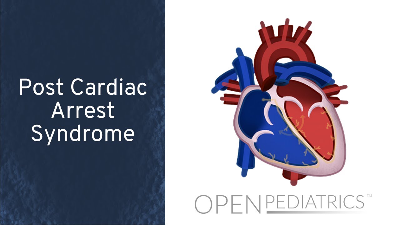 Post-Cardiac Arrest Syndrome by A. de Caen, A. Olszewski, L. DelSignore | OPENPediatrics