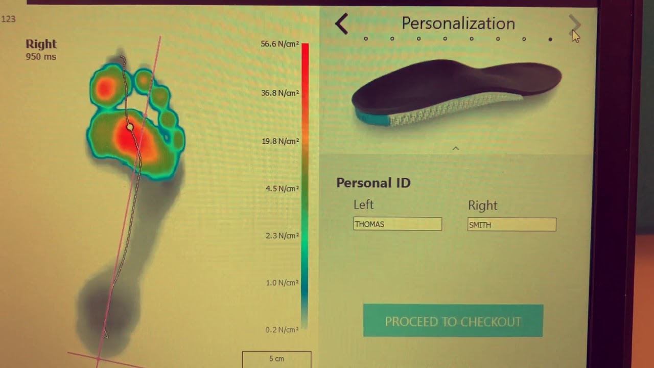 Supafoot introduces FootScan and Phits 3D printed orthoses
