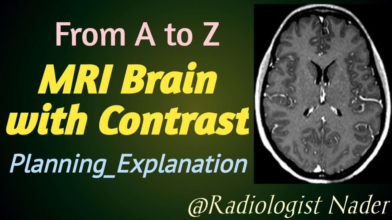 رنين مغناطيسي علي المخ بالصبغة•|•MRI Brain with Contrast