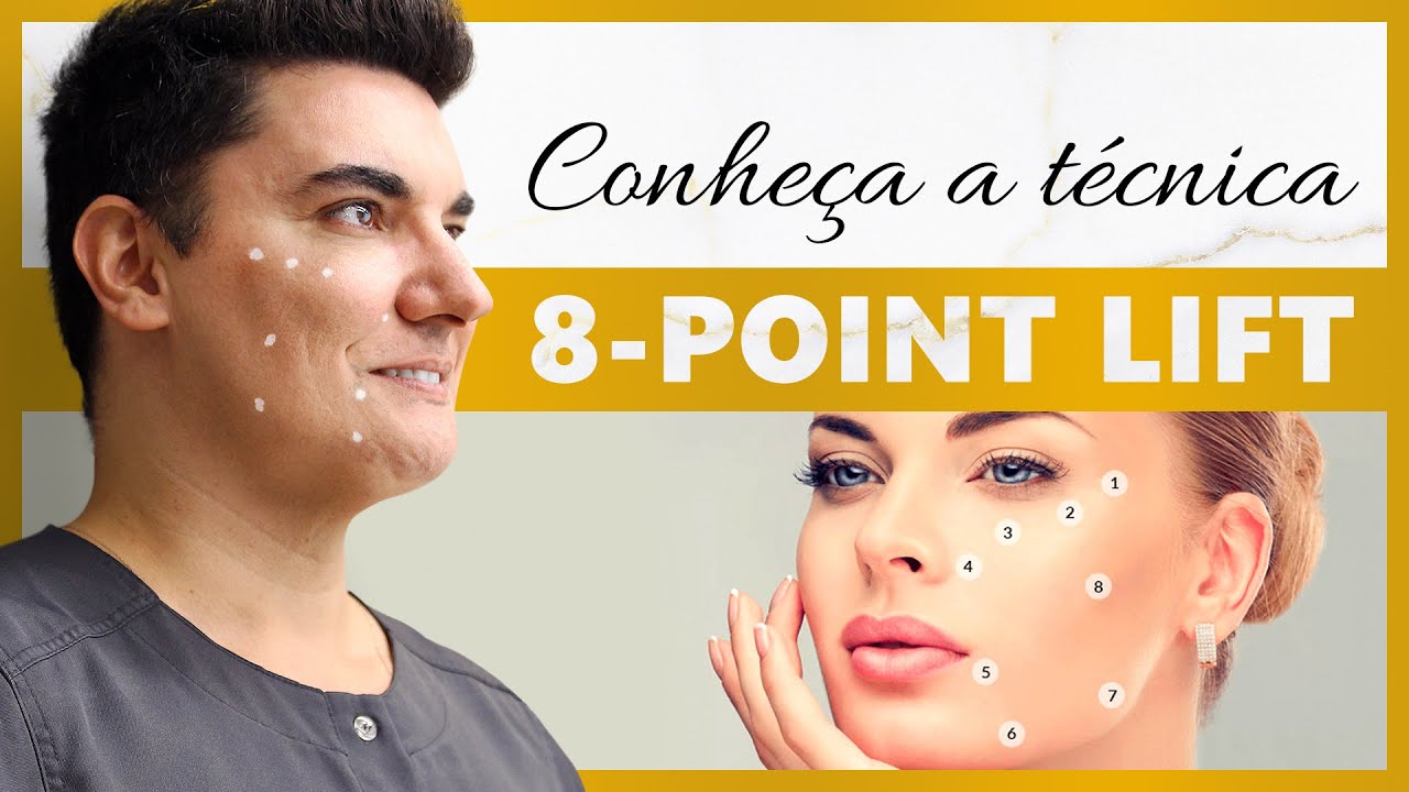 Harmonização facial com 8-Point Lift: Que Técnica é essa? 