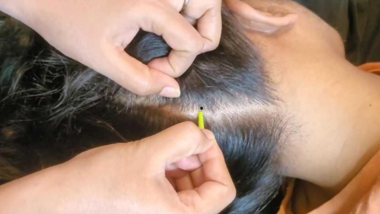 Scalp Checking ASMR, Guaranteed Tingles For People Who NEED Instant Sleep ✨