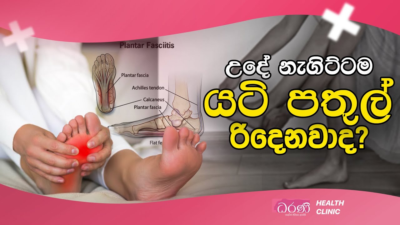 උදේ නැගිට්ටම යටි පතුල් රිදෙනවාද?  | Dharanee Health Clinic