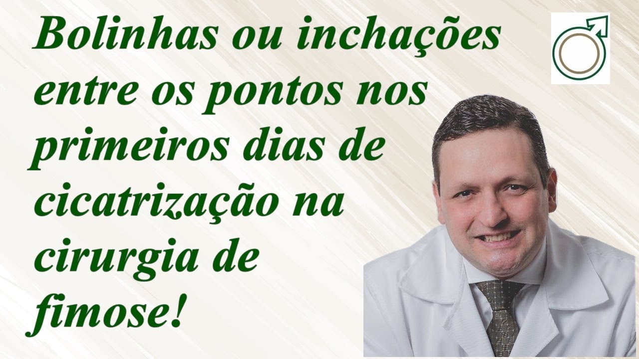 Bolinhas ou gomos, que aparecem logo após o início da cicatrização da cirurgia de fimose!