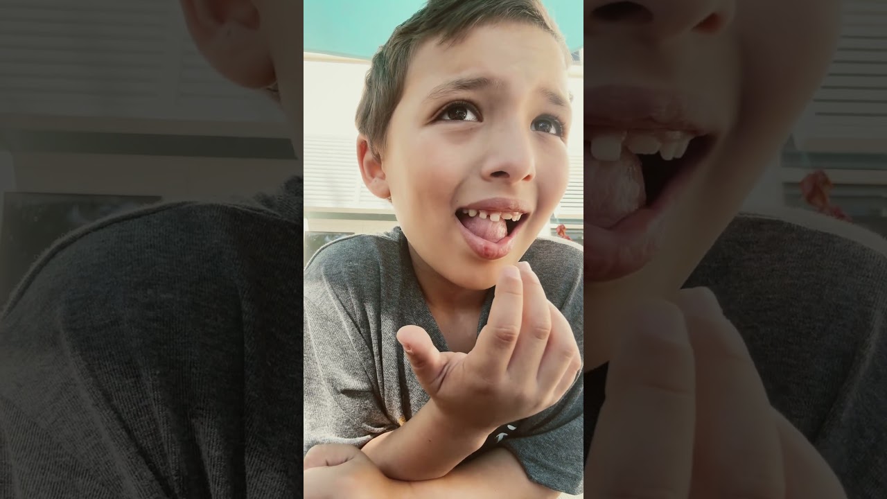 Attempt 2 of pulling off my tooth ￼