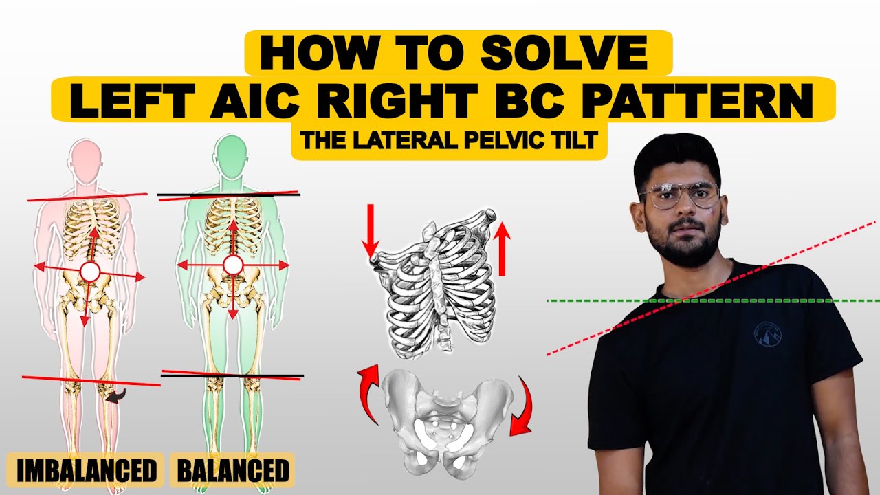 How To Fix a Left AIC Right BC Pattern