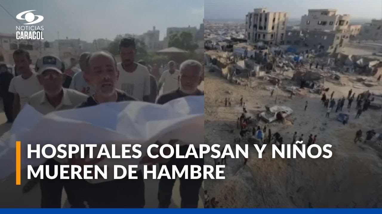 73 niños hospitalizados por desnutrición en Gaza: periodista retrata la tragedia diaria