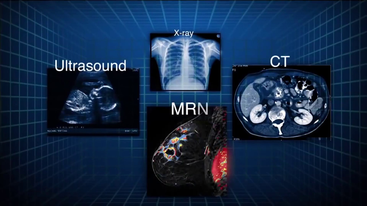 Luciferase-Modified Magnetic Nanoparticles in Medical Imaging