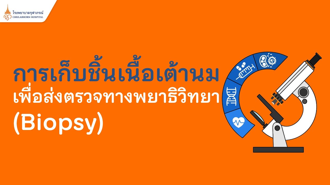 การเก็บชิ้นเนื้อเต้านมเพื่อส่งตรวจทางพยาธิวิทยา (Biopsy)