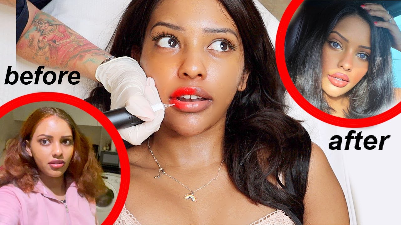 brown girl puts faith in DUBAI surgeons to improve bad genes (5 procedures)