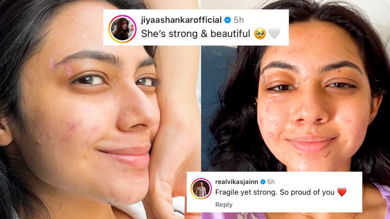 Laughter Chefs: Reem Shaikh Shares Injury PHOTOS; Nia Sharma Jiya Shankar & Sehban Azim REACTS