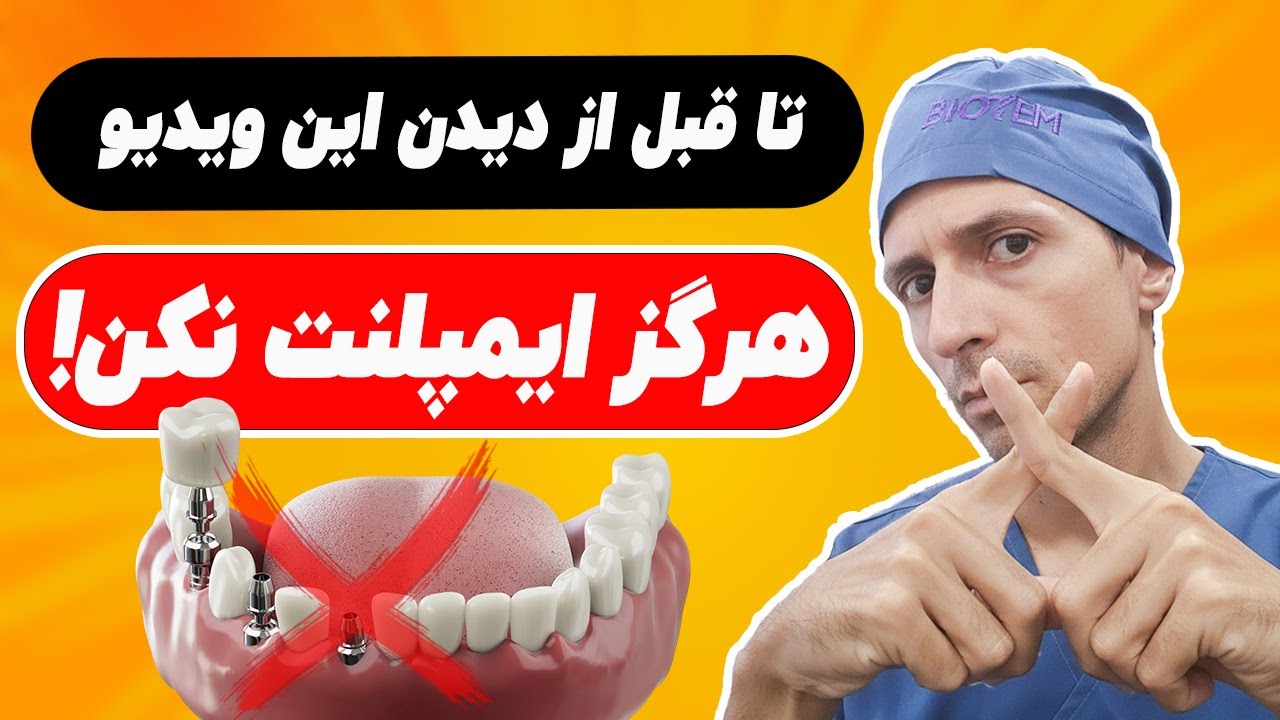 ! اگر ندونی چه ایمپلنت هایی اومده، حتما سرت کلاه میره! | قبل از دیدن این ویدیو هرگز ایمپلنت نکن
