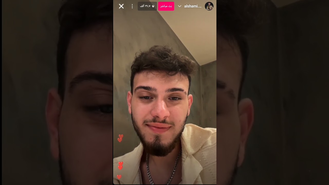 لايف الشامي كامل بدو يكون عيله ؟! 2025/6/17