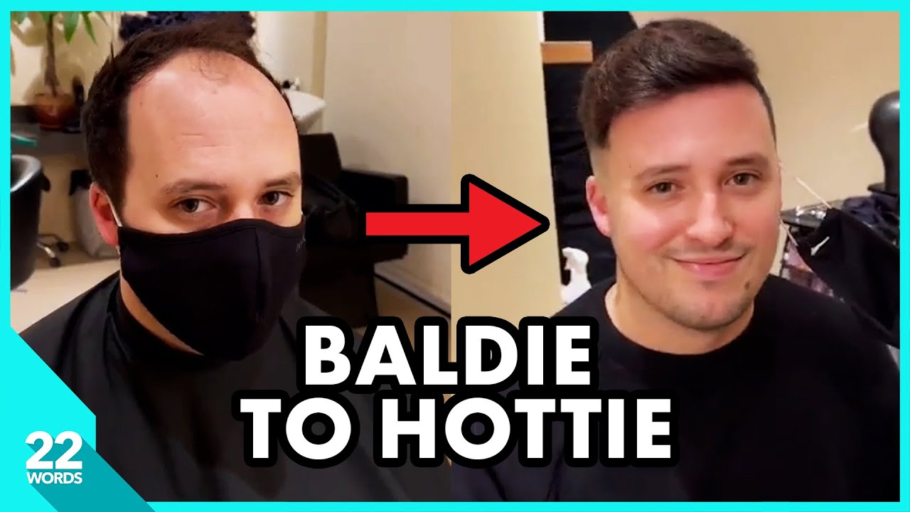 Bald Hairdresser Transforms Men From Bald To Bold
